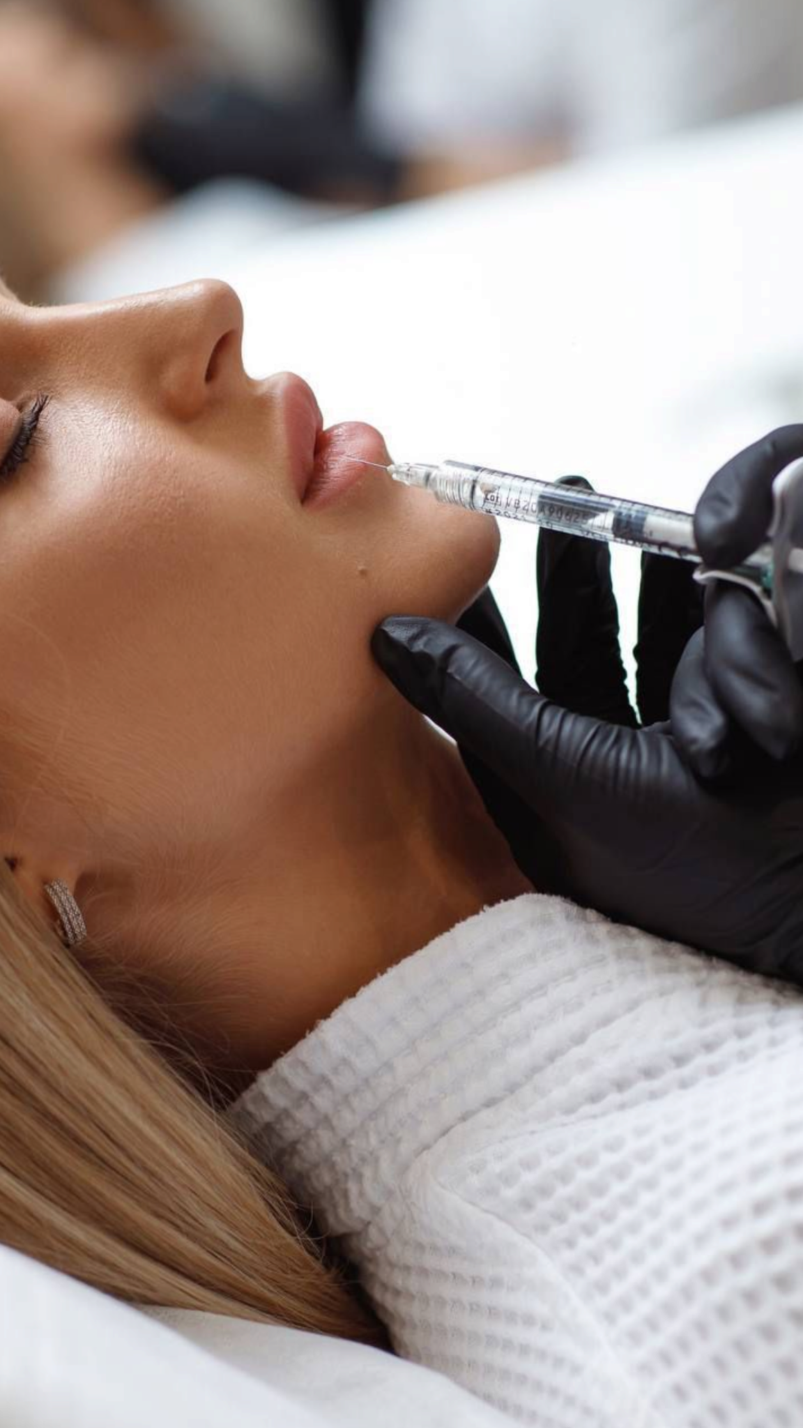 Woman receiving lip filler injections from a gloved hand in a medical setting.