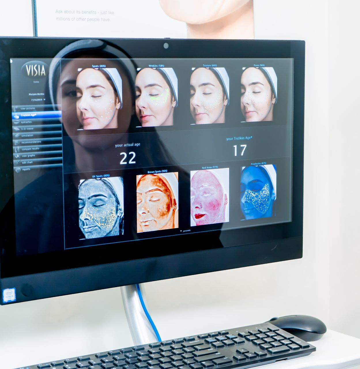 Monitor displaying a skin analysis. The screen shows a face with various highlighted areas, along with a keyboard and mouse.