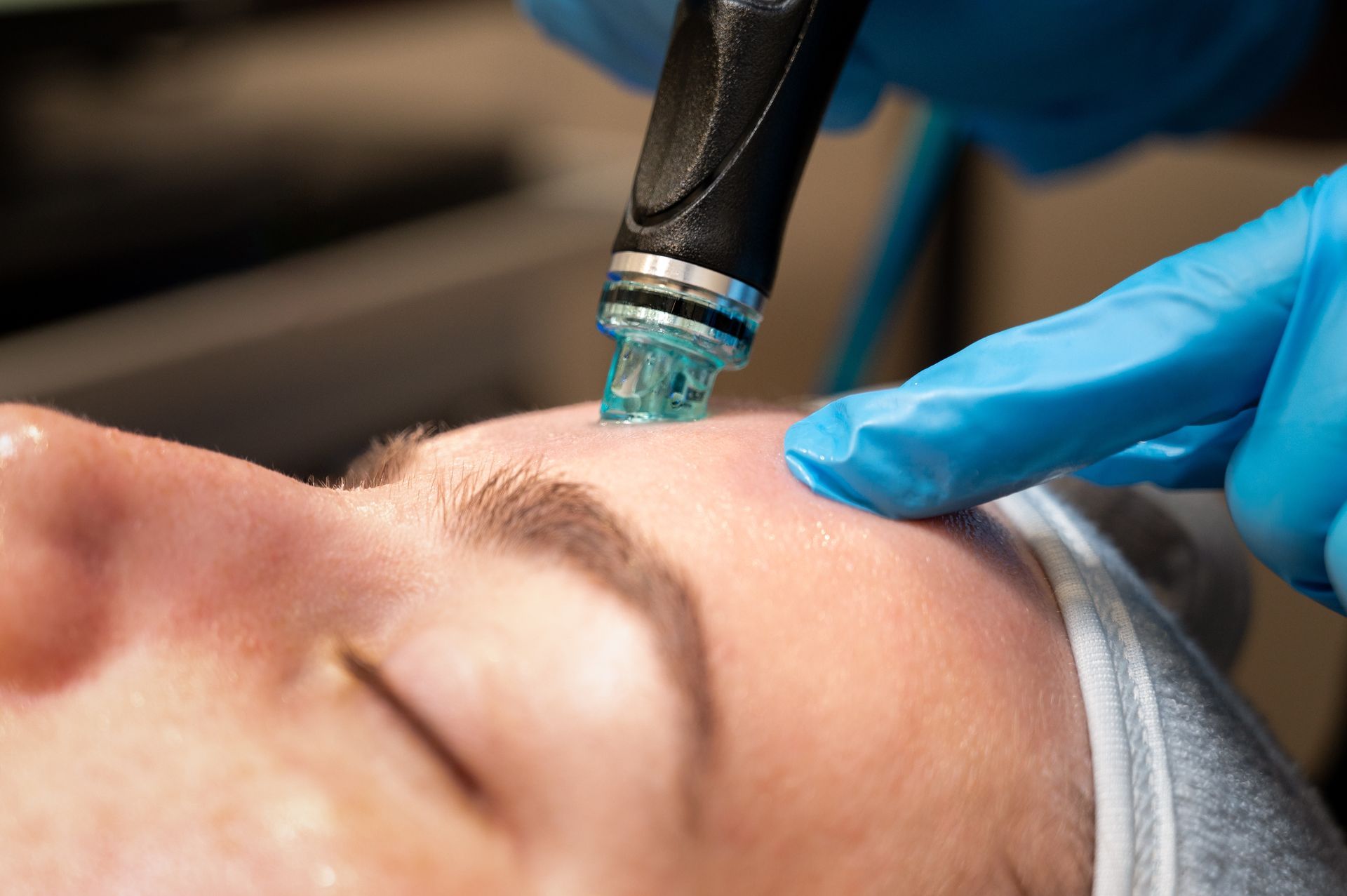 Person receiving facial treatment with a handheld device, blue gloved hand, close up on face.
