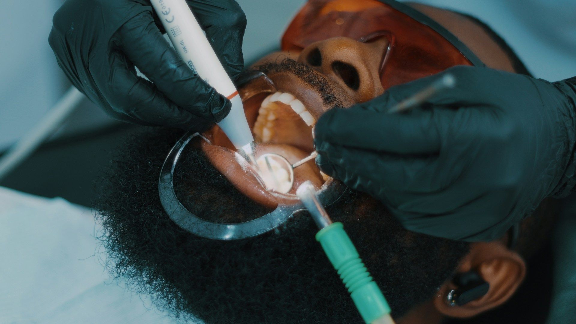 A man getting cavity fillings