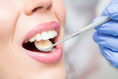 Dentist Checking Filling—Cosmetic Dentistry in Moorpark, CA