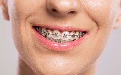 Orthodontic Treatment