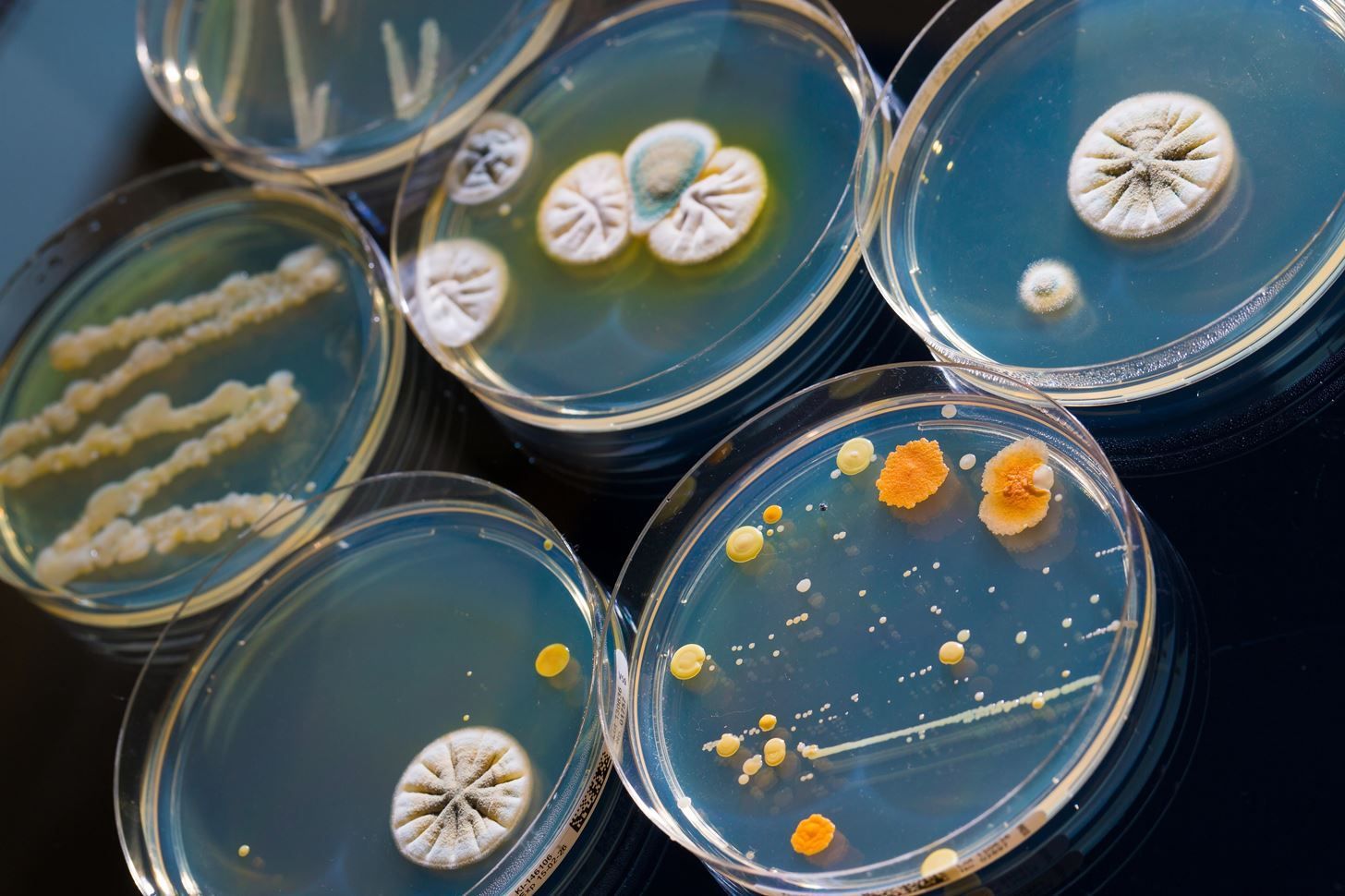A group of petri dishes filled with different types of bacteria.