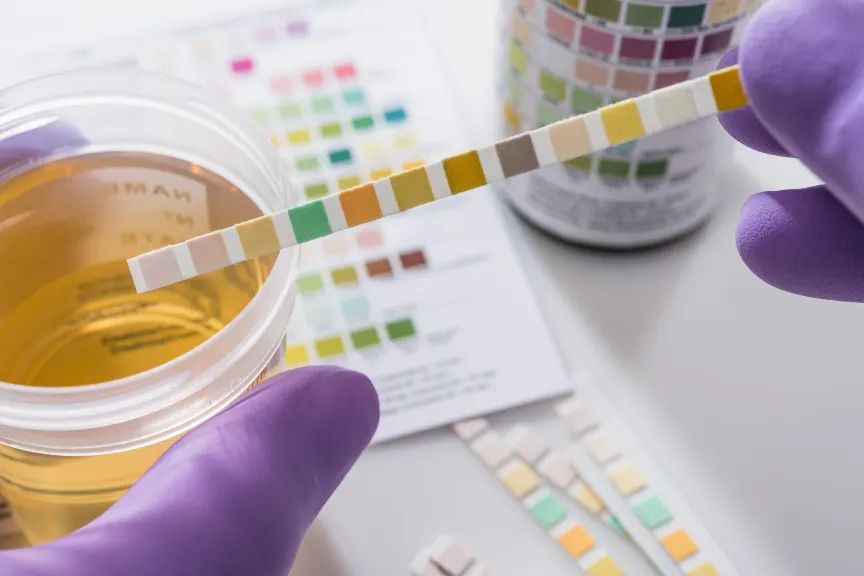 A person is holding a test strip over a cup of urine.
