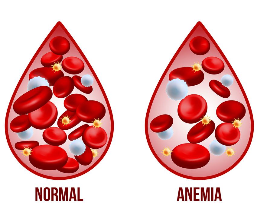Causas anemia