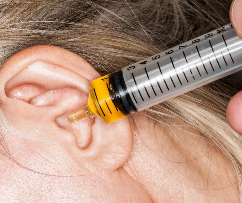 Why Do I Have So Much Earwax, and Can it Affect My Hearing?