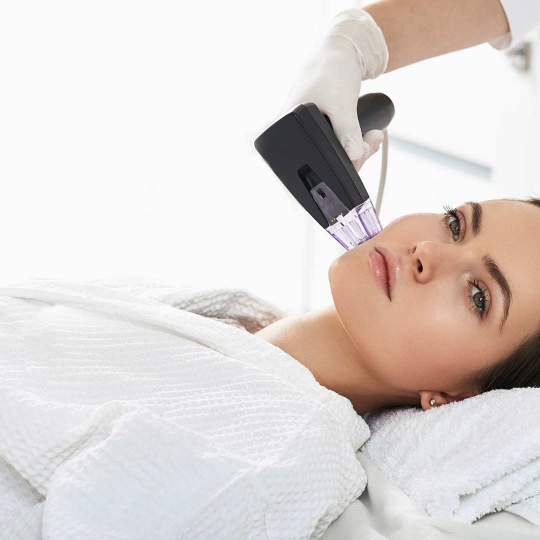 Eine Frau bekommt eine Laserbehandlung im Gesicht.