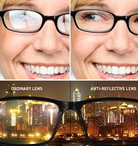 Contact Lens Exams and Fittings | Modern Focus Eyecare