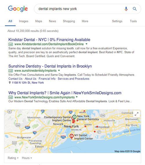 A google search for dental implants in new york