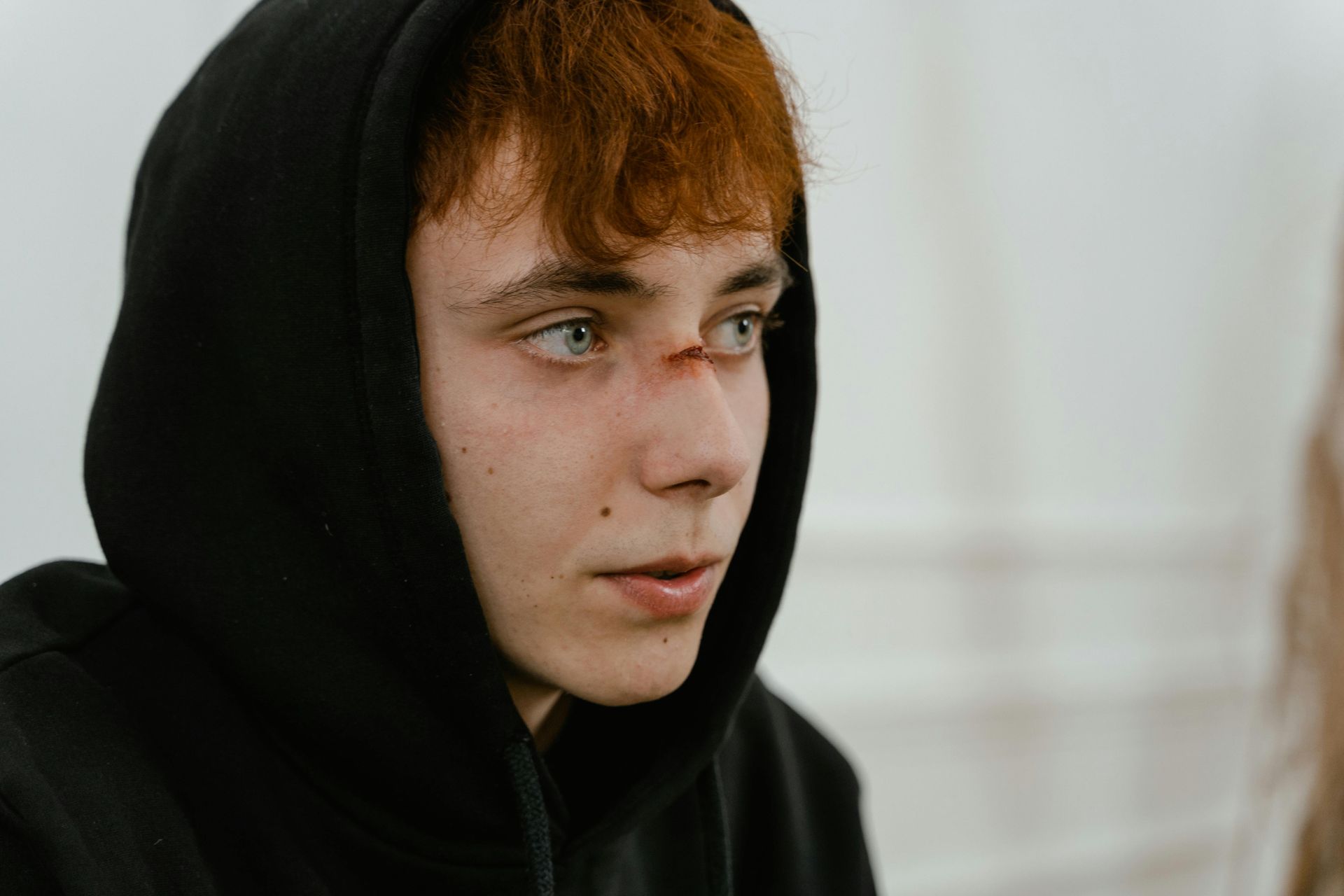 Teenager with a nose wound showing the effects of personal injuries.