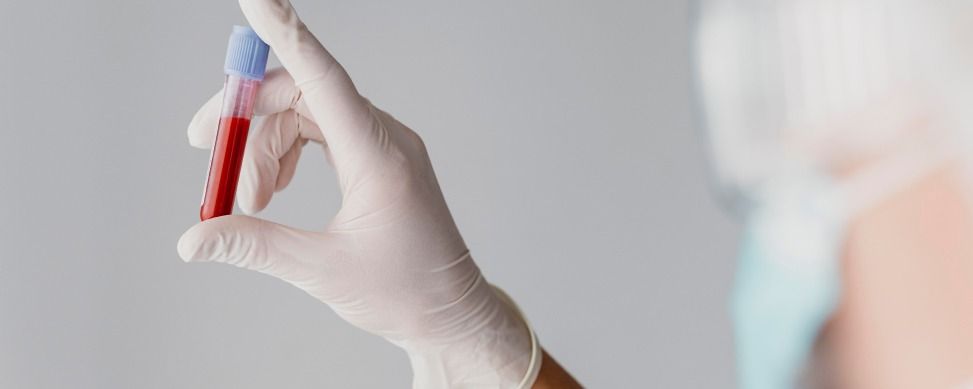 A gloved hand holds a blood collection tube with a light blue cap against a plain light gray background.