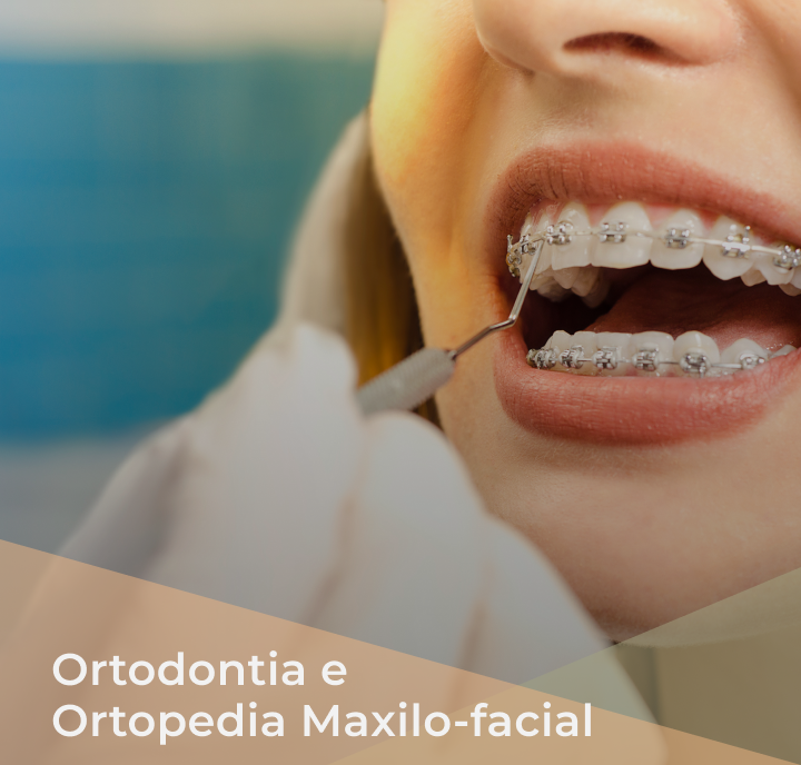 Ortodontia e Ortopedia Maxilo-facial
