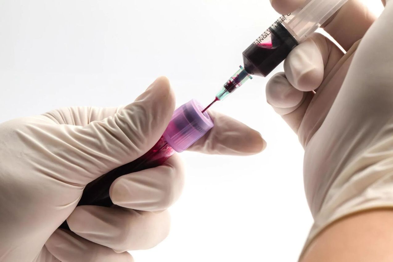 Prelievo del sangue