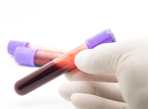 Analisi provetta di sangue