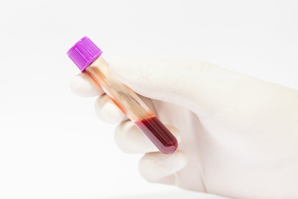 Studio e analisi del sangue