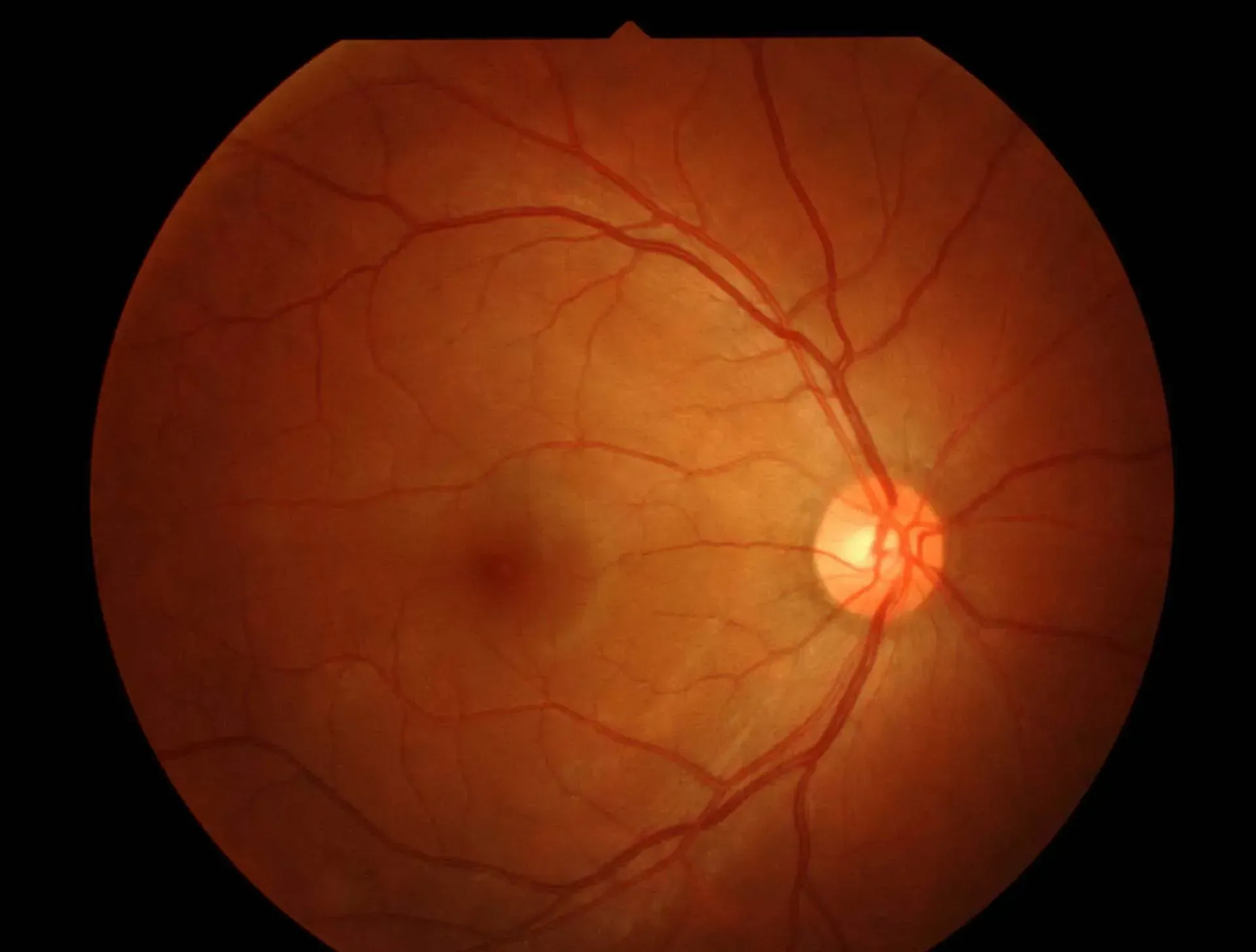 A Person Sits at an Eye Exam Machine With Their Eye Aligned — Peninsula Eyecare Izzards Optometrists in Woy Woy, NSW