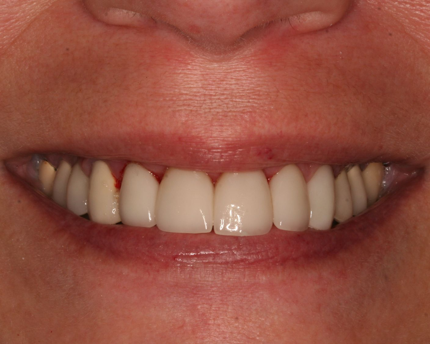 Woman with blue eyes, smiling, light brown hair, visible teeth.