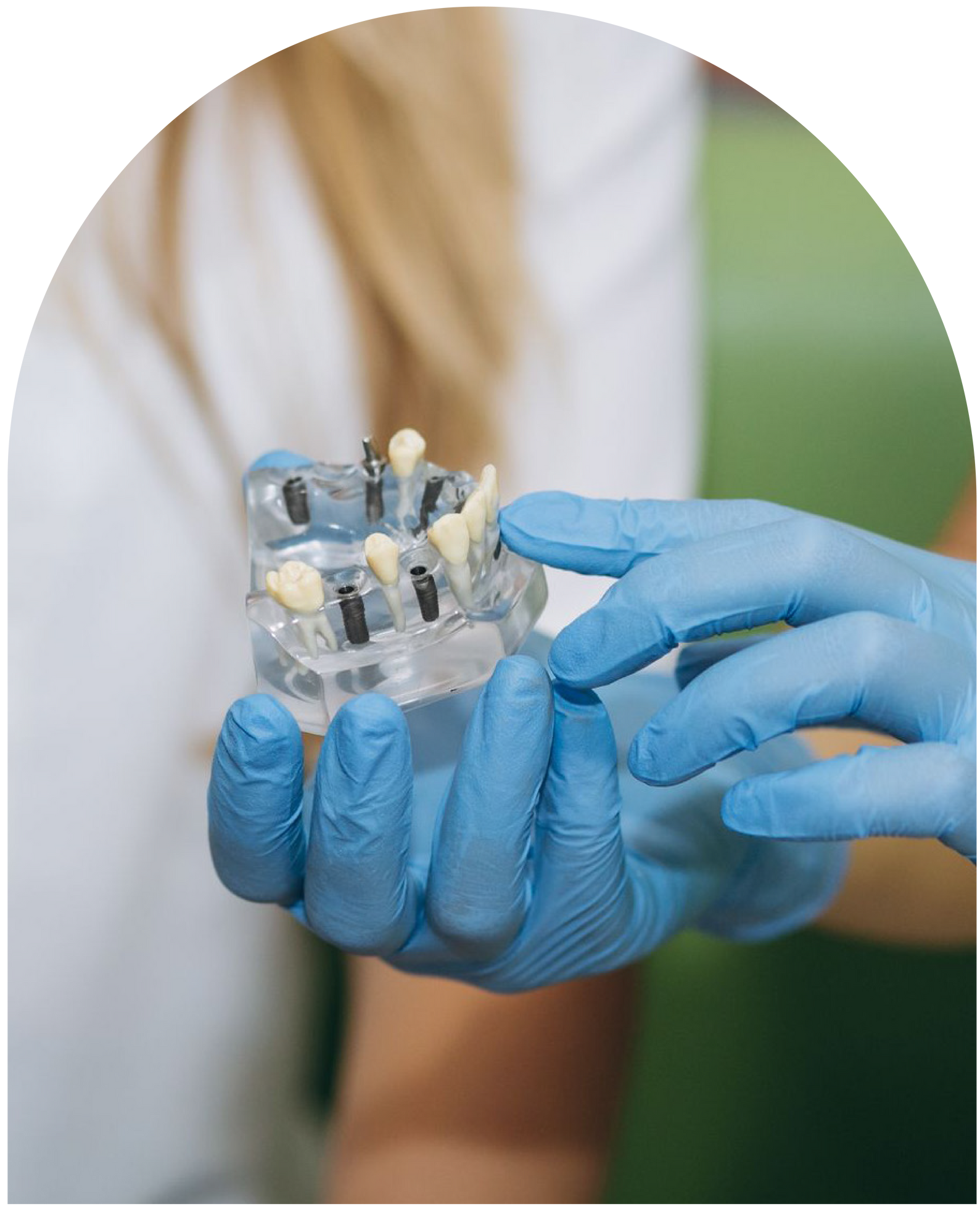 Hands in blue gloves holding and pointing to a dental implant model at Vail Dental Associates in Hunt Valley, MD, 21030.
