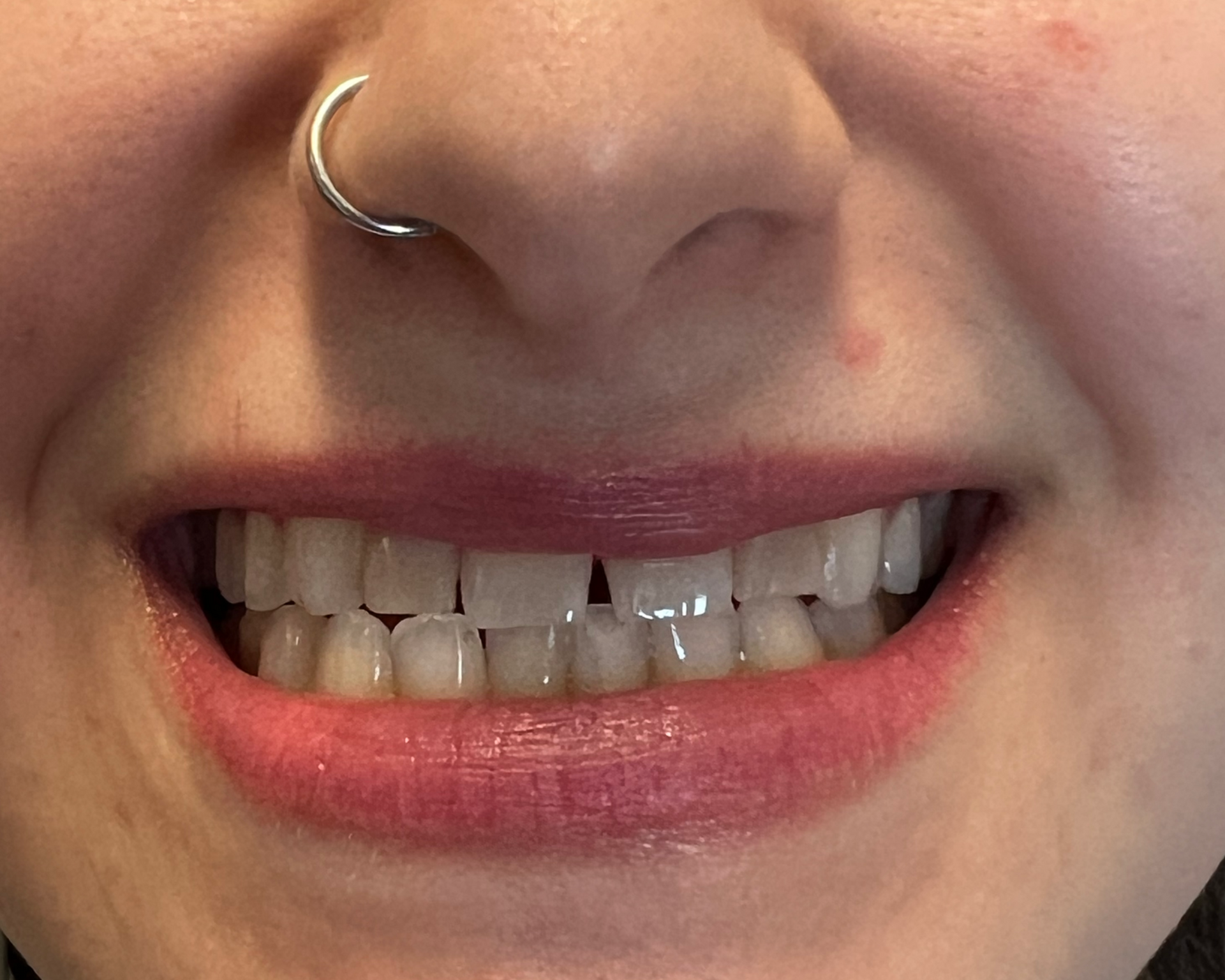 Woman smiling, slightly tilted head. Blonde hair, fair skin, light eye makeup, white teeth.