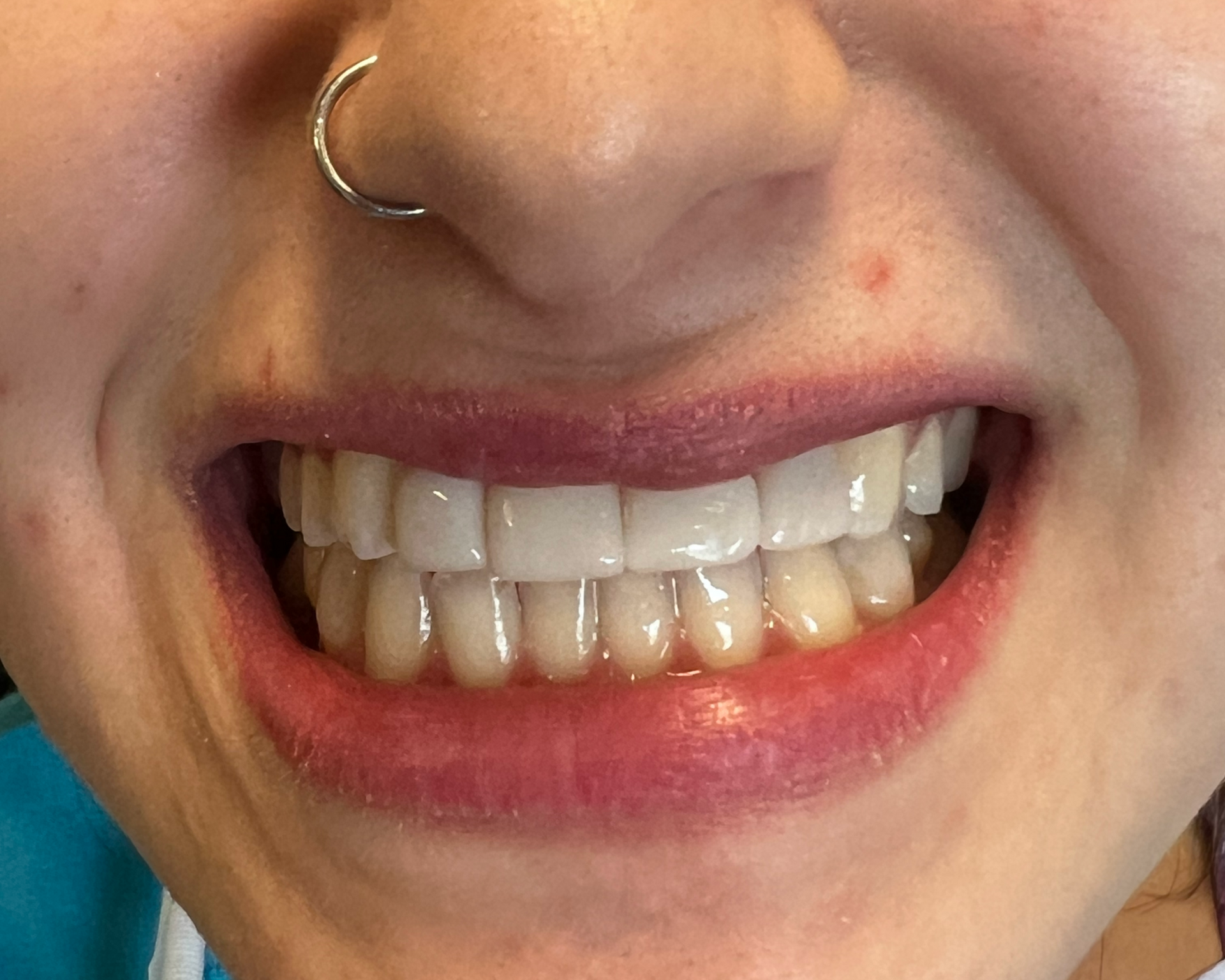 Woman smiling broadly, showing white teeth, with light skin, and eyes.