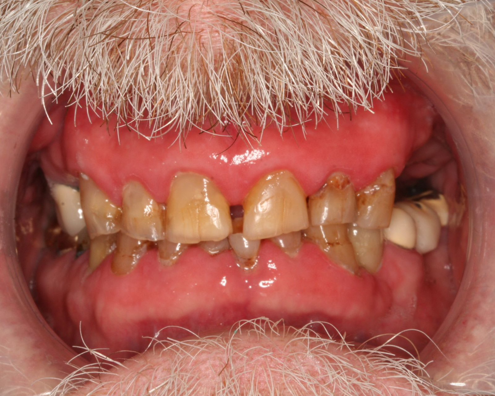 Woman smiling, slightly tilted head. Blonde hair, fair skin, light eye makeup, white teeth.