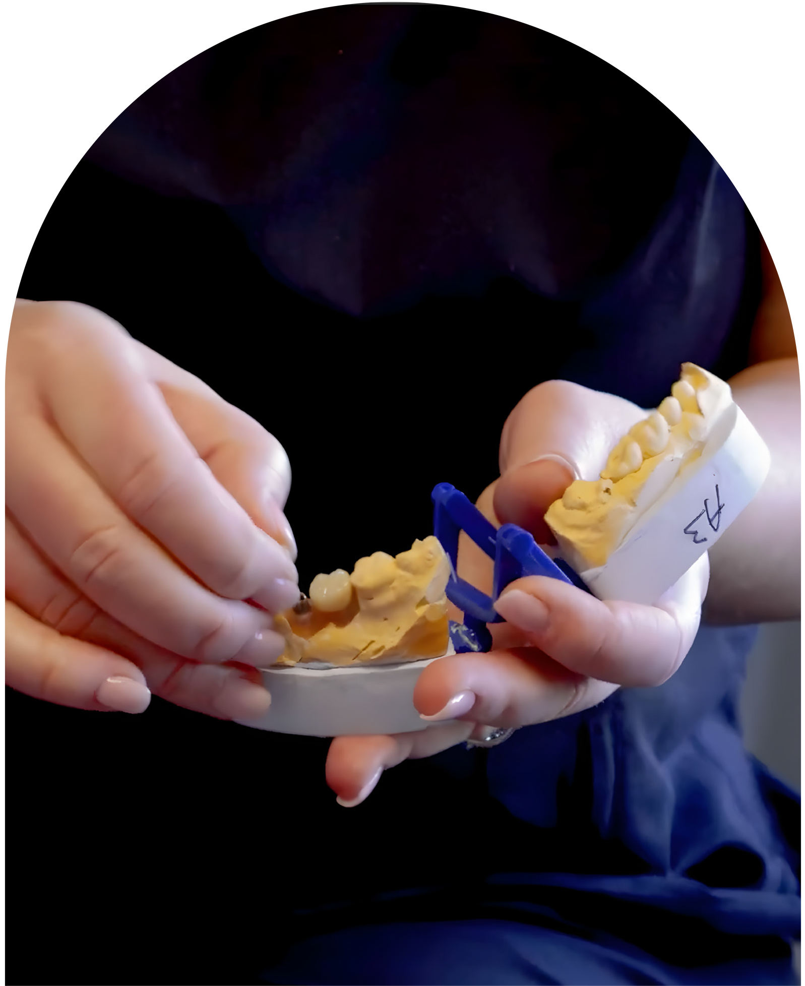 Hands in blue gloves holding and pointing to a dental implant model at Vail Dental Associates in Hunt Valley, MD, 21030.