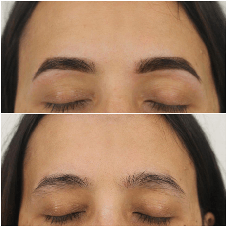 before and after eyebrow treatment