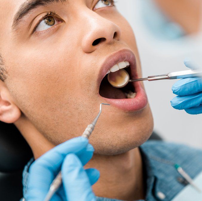 Tooth-Colored Fillings