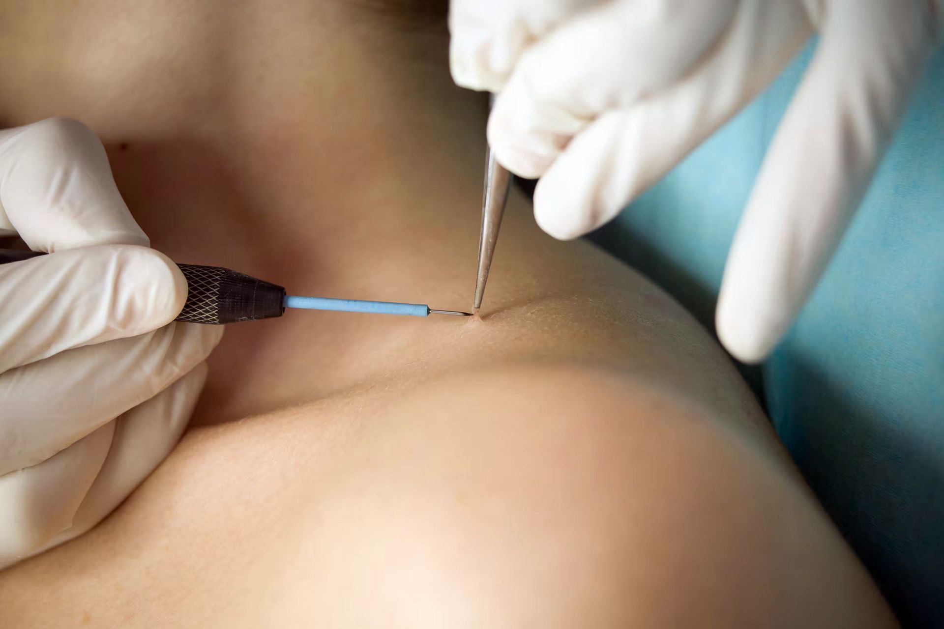 prestazioni chirurgiche dermatologo