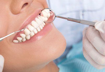 Checking Patient's Teeth — Statesville, NC — Joseph M. Perry, D.D.S., P.A.