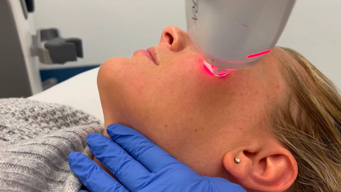 A woman is getting a laser treatment on her face.