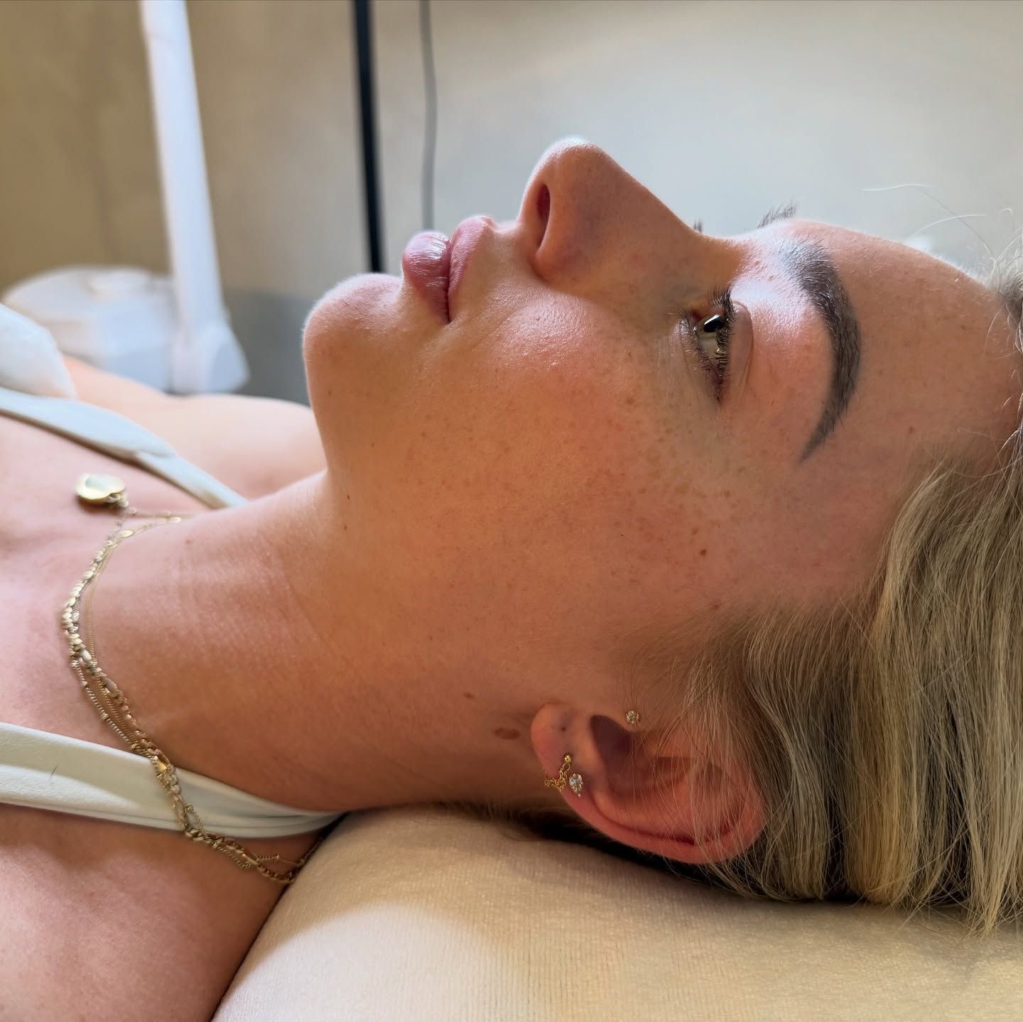 Woman Lying Down, Skin Treatment. She Has Blonde Hair, Wearing a Necklace — That Skin Clinic in Mooloolaba, QLD