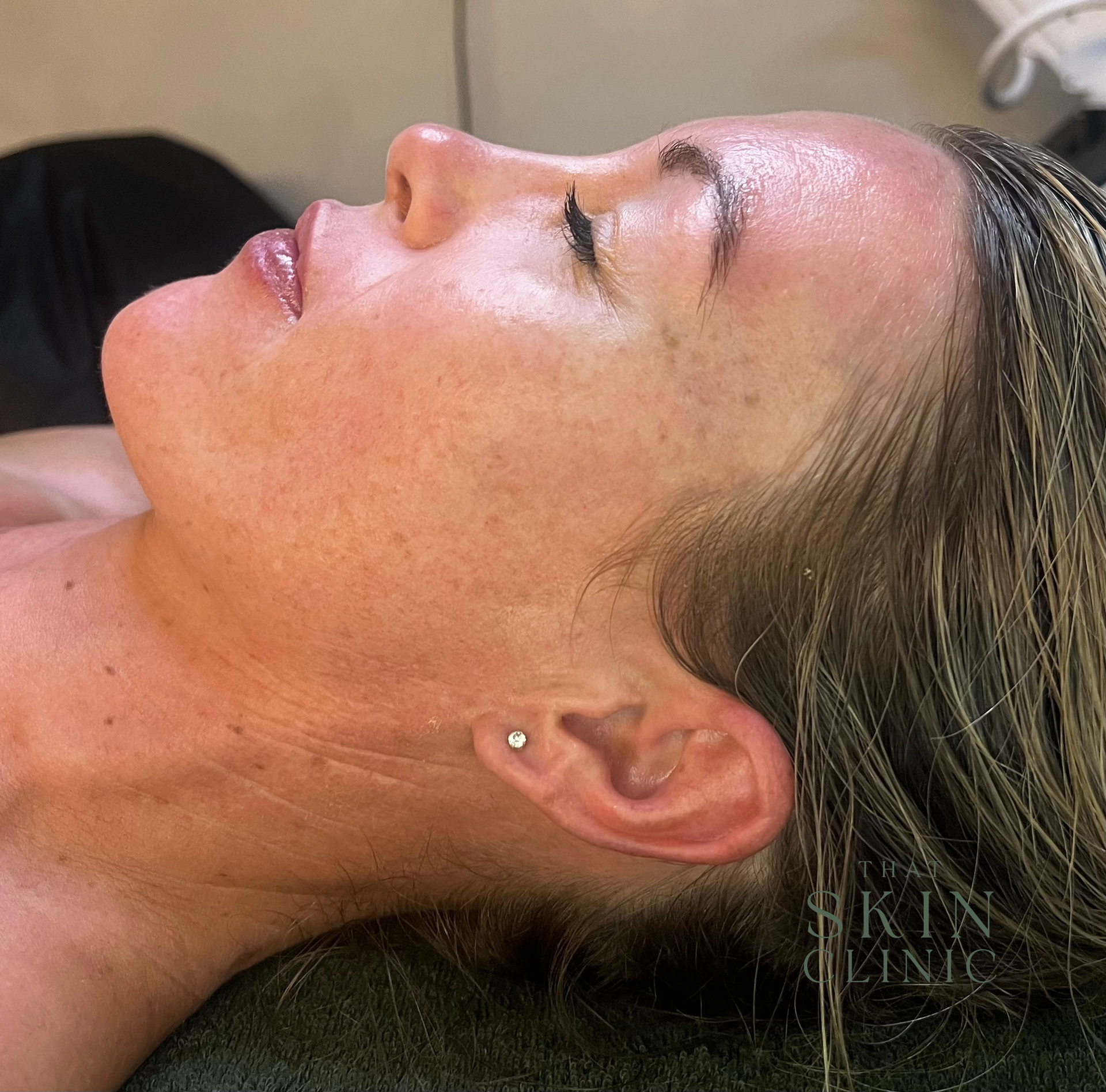 Woman's face in profile, resting. Skin appears slightly wet, with a small earring.