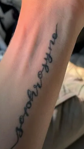 Side-by-side comparison of a wrist tattoo before and after 7 treatments of removal, showing fading ink.