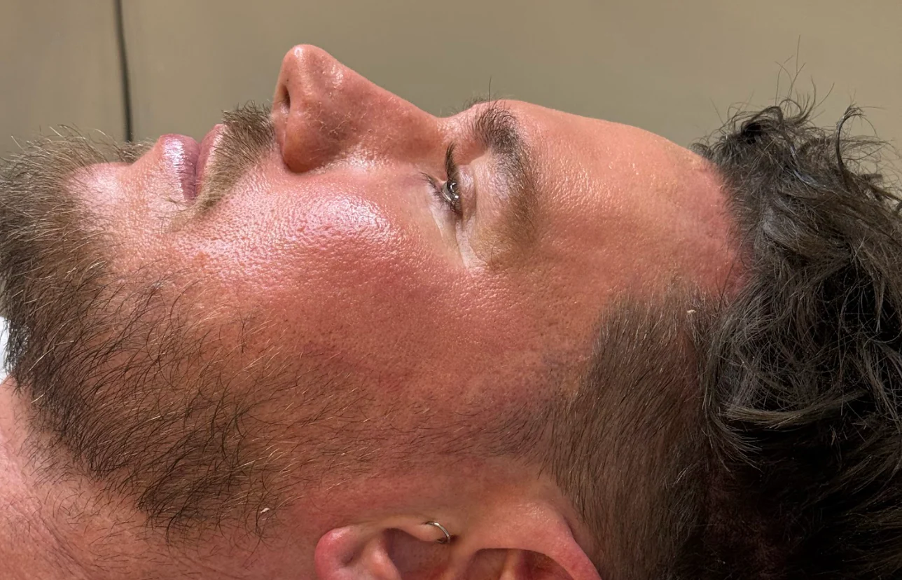 Man Lying Down — That Skin Clinic in Mooloolaba, QLD