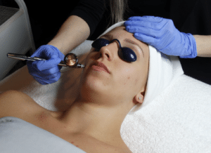 Oxygen Facial for Skincare