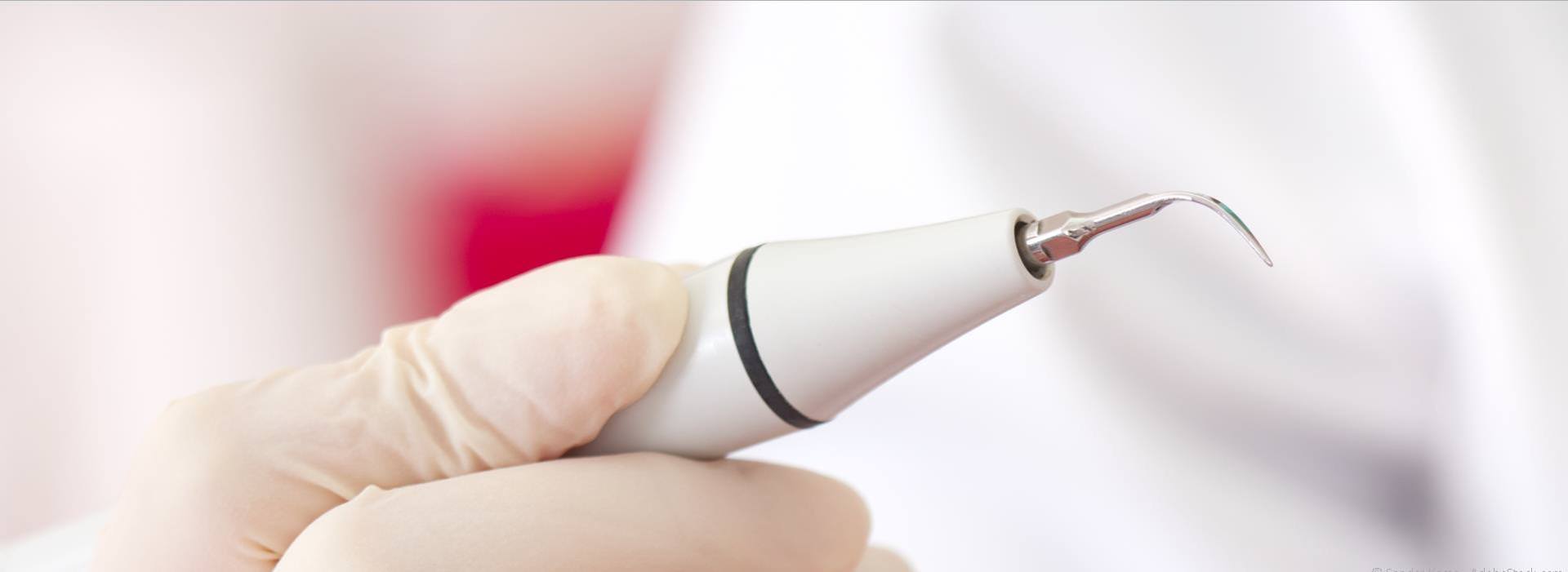 Wie wird eine Parodontitis behandelt?