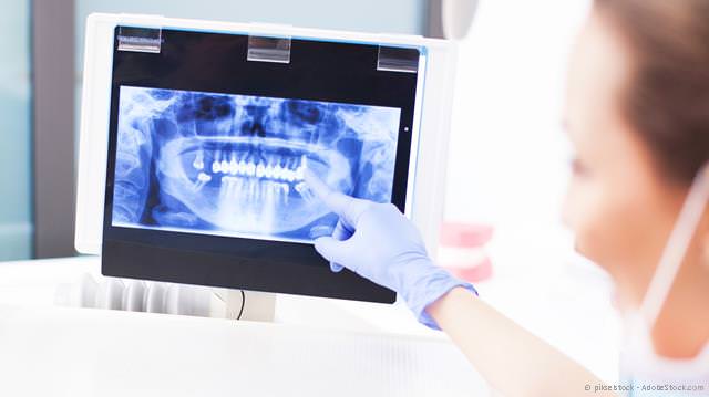 Wie wird eine Parodontitis diagnostiziert? Wie wird eine Parodontitis diagnostiziert?