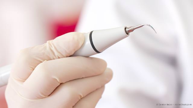 Wie wird eine Parodontitis behandelt? Wie wird eine Parodontitis behandelt?