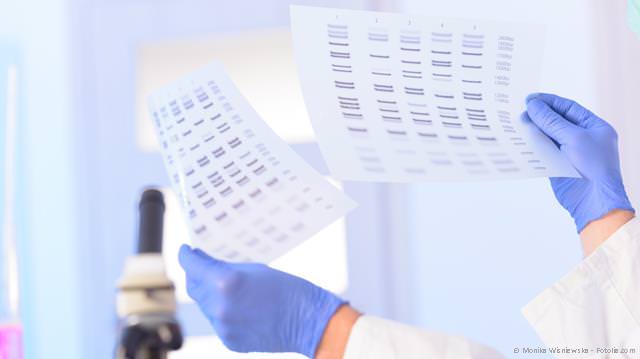 DNA-Test: Besteht ein genetisches Risiko, an Parodontitis zu erkranken?