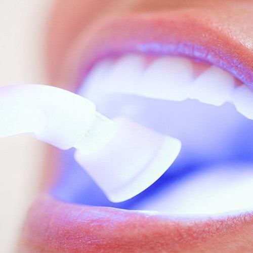 A woman is getting her teeth whitened with a light.