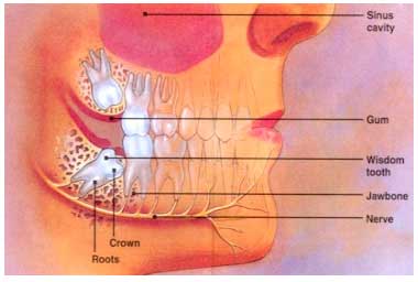 illustration of person sideways - wisdom teeth