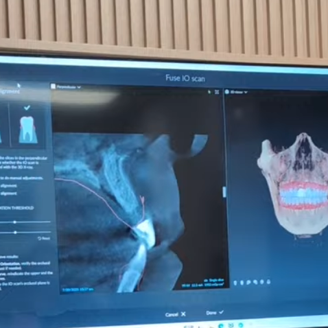 dental implant 3d planning