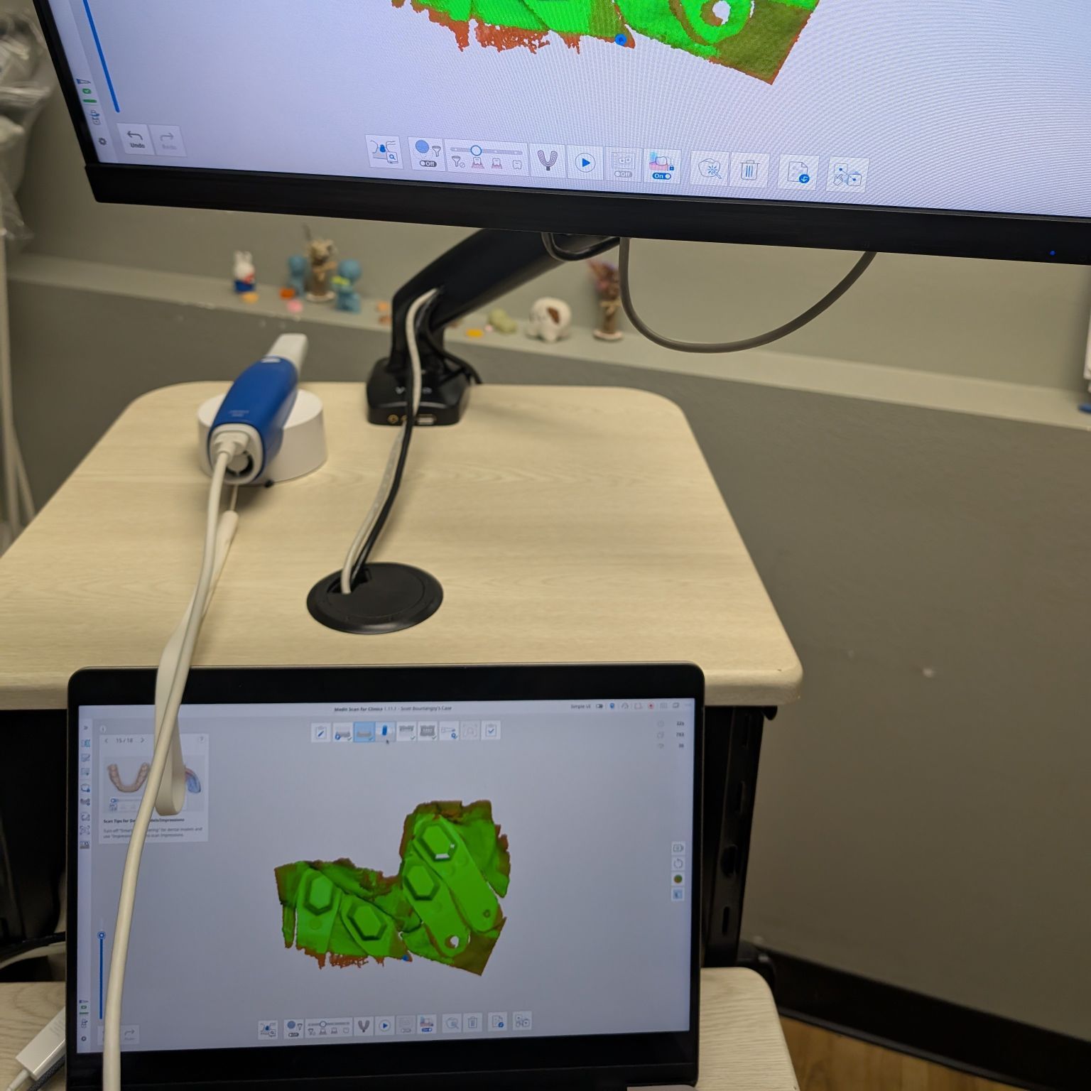 dental implant placement, oral surgery, extraction, immediate implant, painless, near me
