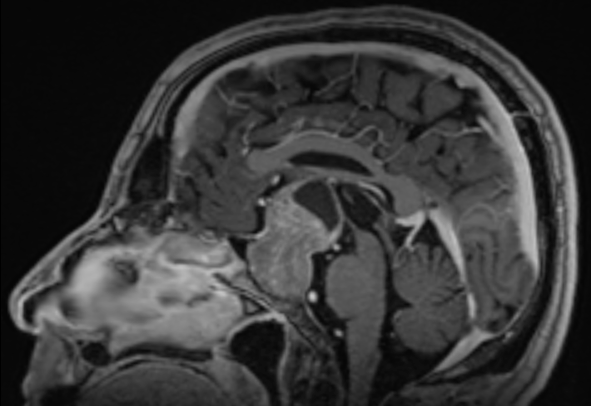 Una imagen en blanco y negro del interior de un cerebro humano.