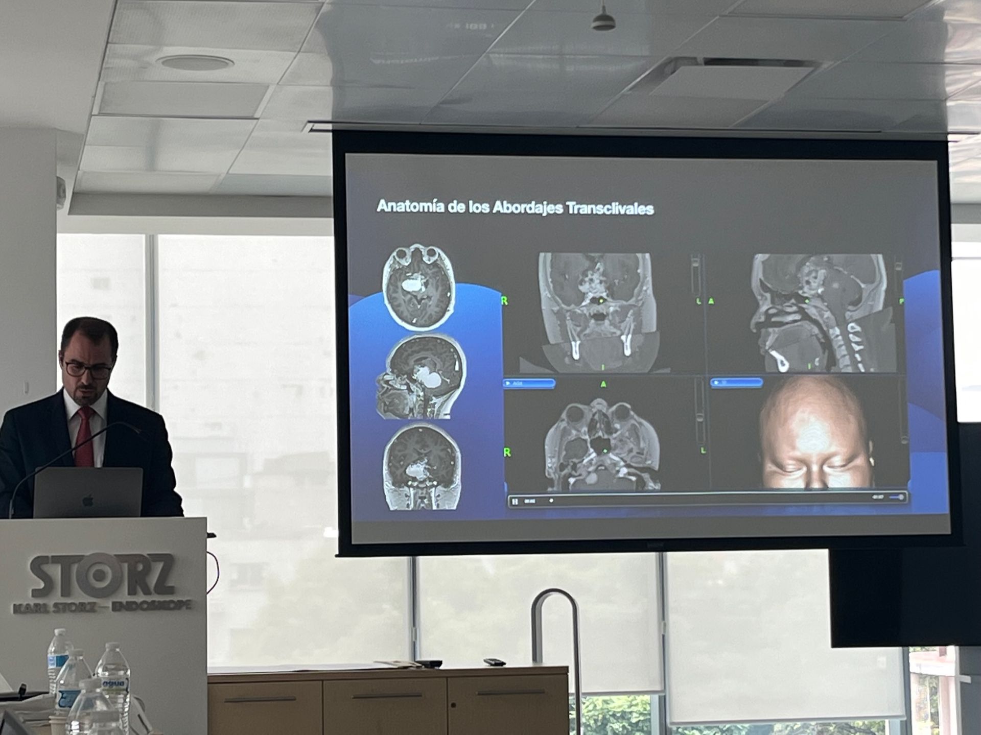 Un hombre está dando una presentación frente a una pantalla grande.