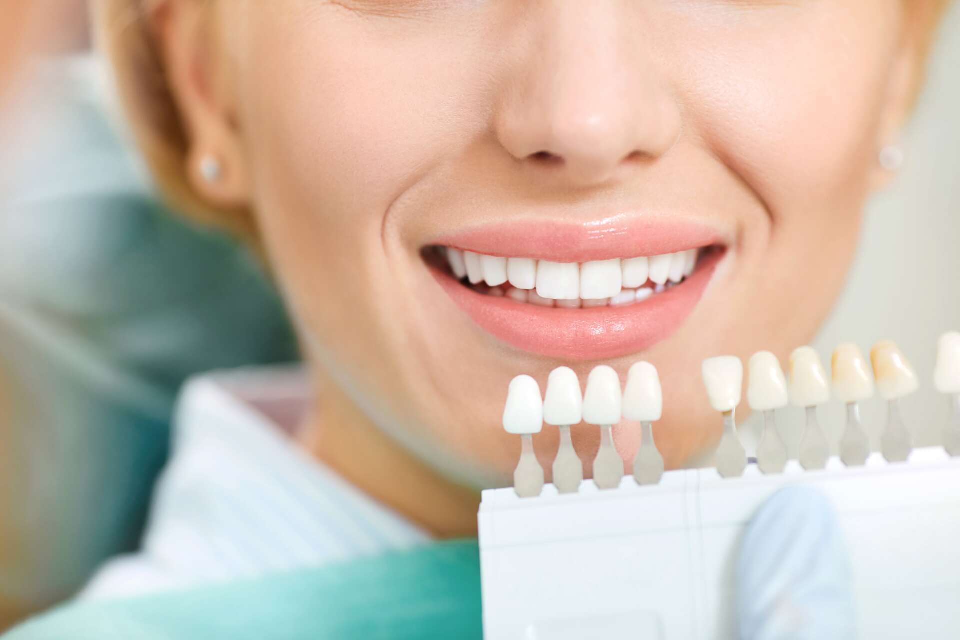 Frau beim Zahnarzt zum Zahnbleaching