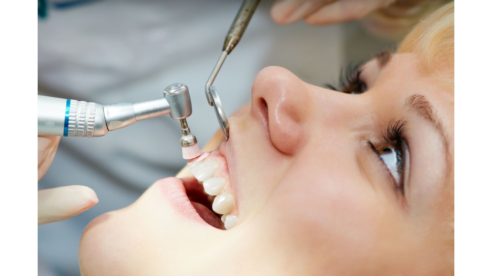 Preventive Dentistry