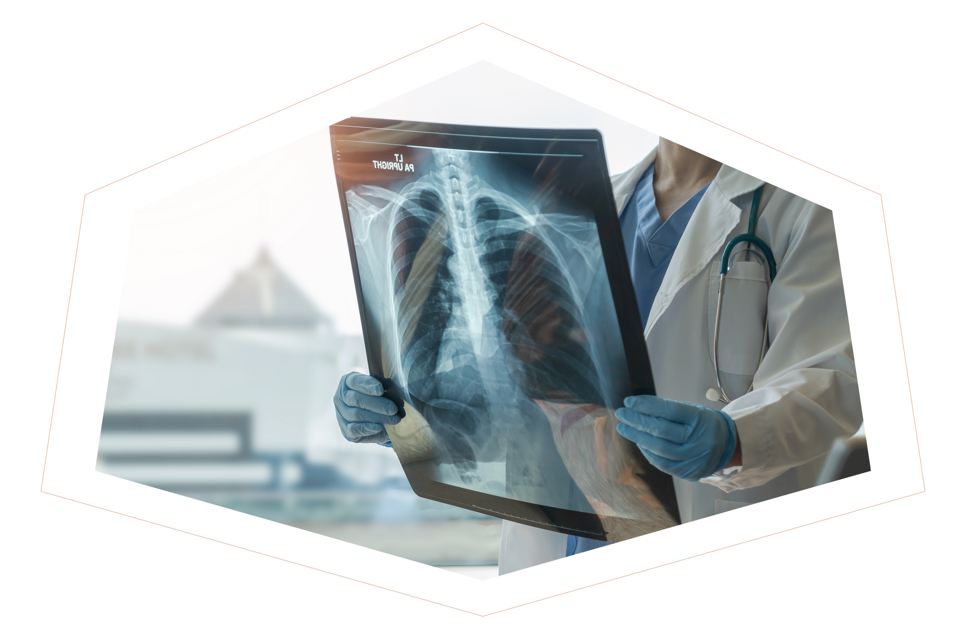 A doctor is holding an x-ray of a person 's chest.