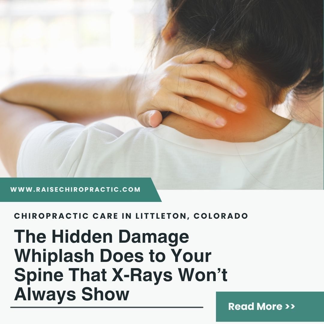 The Hidden Damage Whiplash Does to Your Spine That X-Rays Won’t Always Show